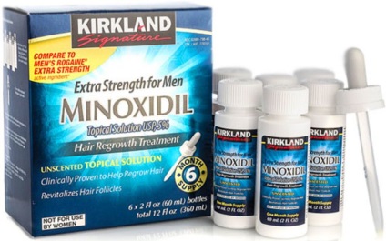 четения миноксидил коса, използването, истинските мъже и жени, блог за коса