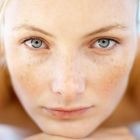 Kisasszony ingerlékenység, hogyan lehet segíteni az érzékeny bőrt - bőrirritáció, érzékeny bőr