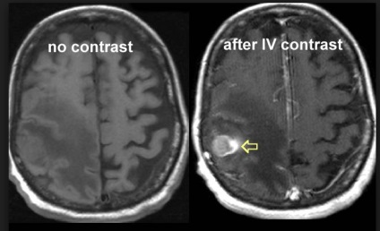 MRI azt mutatja, hogy a máj (kontraszt képalkotás)