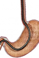 Oncologie, Sankt-Petersburg, Departamentul de Oncologie, Spitalul Municipal 40