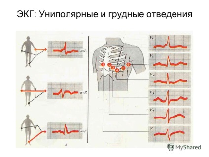 Bemutatása az EKG (elektro-kardiográfiához) kimutatására szolgáló eljárás elektromos szív potenciálok