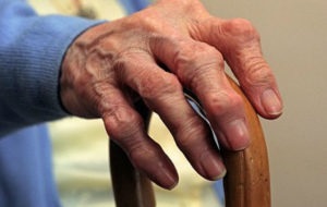 Sertésfülek osteoarthritisében hogyan lehet megkönnyíteni a a betegség lefolyását