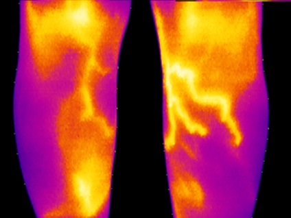 Termográfia a tengerparti kerület St. Petersburg, a gerinc klinika orvos Razumovsky