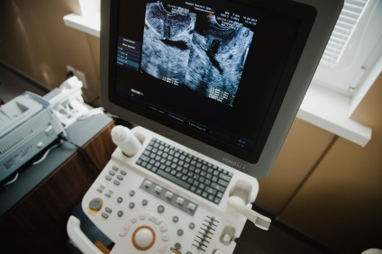 Ultrahang diagnosztika, a férfiak egészségének klinika