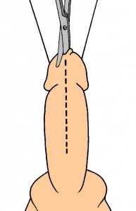 Urethroplasty - műtét húgycső szűkület, Központi Klinikai Kórház № 1, Moszkva helyszínen