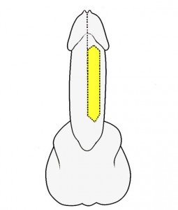 Urethroplasty - műtét húgycső szűkület, Központi Klinikai Kórház № 1, Moszkva helyszínen