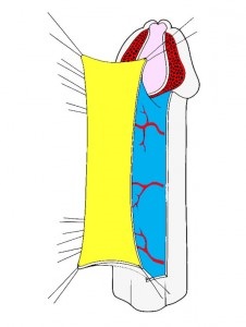 Urethroplasty - műtét húgycső szűkület, Központi Klinikai Kórház № 1, Moszkva helyszínen