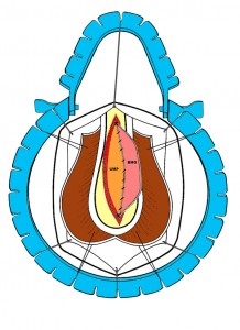 Urethroplasty - műtét húgycső szűkület, Központi Klinikai Kórház № 1, Moszkva helyszínen