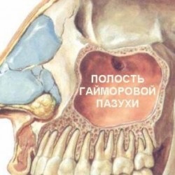 Sinuzul sinillus, sinusurile stângi și drepte, funcțiile și trăsăturile lor, totul despre sinuzită