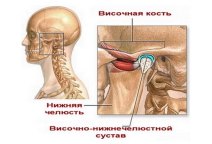 Dislocarea maxilarului inferior