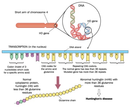 Chorea Huntington, simptome și tratament, modalități de diagnosticare