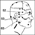 35 - Acupunctura fără ace