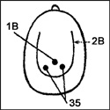 35 - Acupunctura fără ace