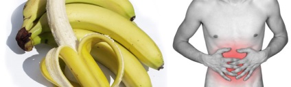 Bananele cu gastrită cu aciditate crescută sau scăzută sunt posibile sau nu, contraindicații