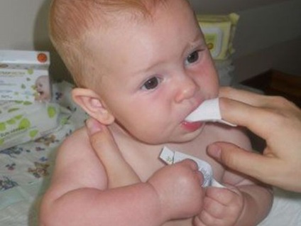 Acoperirea albă a limbii sugarilor a alăptat (în gura copilului)
