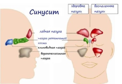 Creste si cauzeaza nasterea si curele