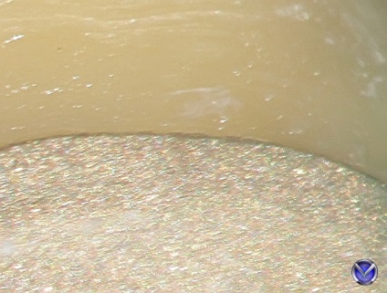 Photo cirkónium koronák fül fül extrakciós kezelés mikroszkóppal