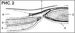 Herniile liniei de spihelium