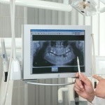 Implantarea cu absenta completa a dintilor