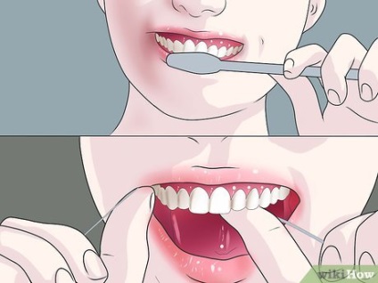 Hogyan fehéríti a fogakat