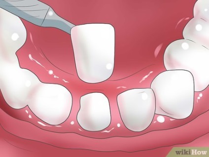 Cum de a albi dinti