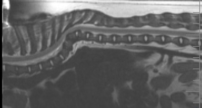 Cifoza coloanei vertebrale toracice la câini de rasă pitică și mică