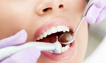 Tratamentul cariei dentare, prețuri și recenzii, cum să scapi de carii adânci
