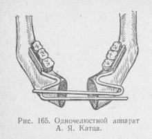 Tratamentul fracturilor maxilarului inferior cu utilizarea dispozitivelor de reponare, stomatologie ortopedică