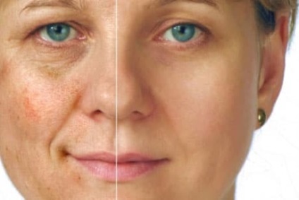 Facial masaj pe un jacquer - piele curată și sănătoasă facială, în doar 10 proceduri