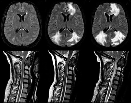 Mirtul coloanei vertebrale cervicale de la Moscova, unde poți să faci ieftin la un cost redus, cu contrast