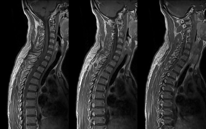 Mirtul coloanei vertebrale cervicale de la Moscova, unde poți să faci ieftin la un cost redus, cu contrast