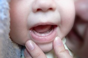 Ordinea dentiției în simptomele copiilor și, de asemenea, formula dentară