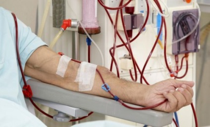 Purificarea sângelui din picături de toxine, produse, preparate