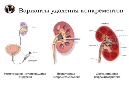 Departamentul de Urolitiază, Urologie și Radiologie Intervențională