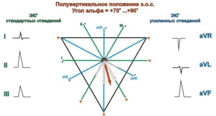 Poziția semi-verticală a axei electrice a inimii, semnele verticale e