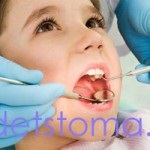 Cauzele cariilor copilului din gura unui medic