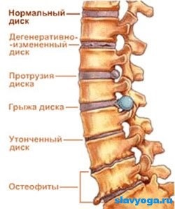 Deformări înapoi în yoga, yoga, slavyoga