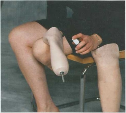 Térdprotézis szilikon bélés