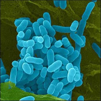 Pseudotuberculosis (sajtos nyirokcsomó-gyulladást) nyulak, omedvet