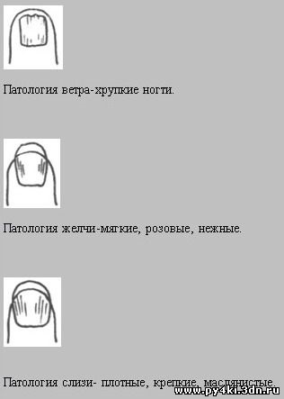 Diverse lecții de boli ale unghiilor pentru bolile libere, diverse, diverse boli ale unghiilor