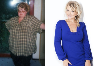 Az igazi történet arról, hogyan vesztettem 100 kg (segítségével a műtét és a diéta) - a test