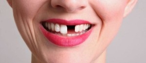 Interpretarea visului zdrobeste dintii si cade - cum arata fara sange si durere