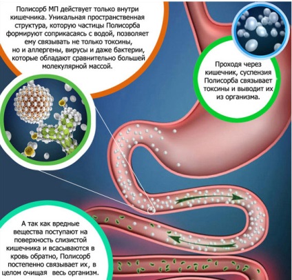 Sorbente pentru curatarea intestinelor la copii si adulti, remedii medicinale si naturale