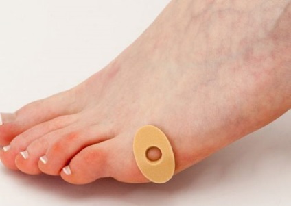 Remedy száraz bőrkeményedés a lábujjak, hogyan kell kezelni az emberek segítségével