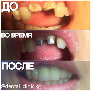 Fotografiile stomatologice din contul @ instagram