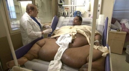 Top legtöbb kövér ember a világon, hogy állítsa le a súlyt