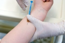 Mantoux tuberkulin bőrteszt