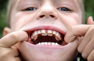 Copilul este în creștere un rând de dinți al doilea rând sau lapte de coacere ce să facă