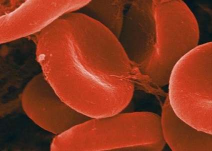 Nivelul de hemoglobină din sânge și tensiunea arterială este ceea ce este legătura - răspunsurile și