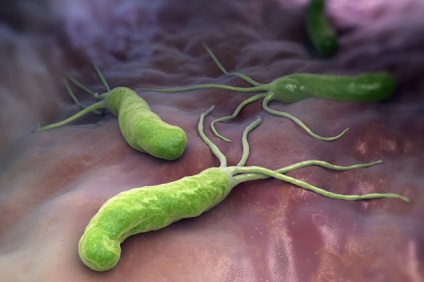 Helicobacter pylori este foarte gravă, întotdeauna în formă!